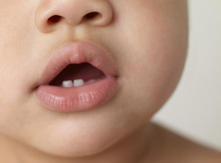 Baby Teeth
